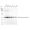 LifeSab™ FGF7 Rabbit mAb (20 μl)