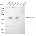 LifeSab™ ALDH1A2 Rabbit mAb (20 μl)