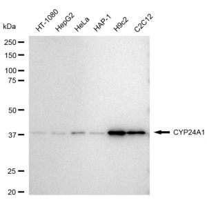 LifeSab™ CYP24A1 Rabbit mAb (20 μl)