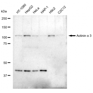 LifeSab™ ACTN3 Rabbit mAb (20 μl)