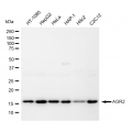 LifeSab™ AGR2 Rabbit mAb (20 μl)