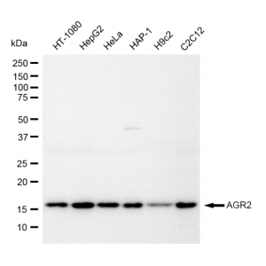 LifeSab™ AGR2 Rabbit mAb (20 μl)