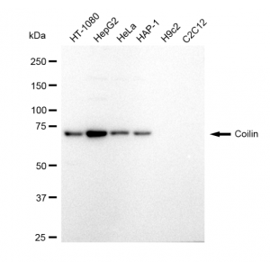 LifeSab™ Coilin Rabbit mAb (20 μl)