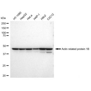 LifeSab™ ACTR1B Rabbit mAb (20 μl)