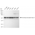 LifeSab™ ATF4 Rabbit mAb (20 μl)