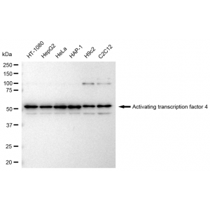 LifeSab™ ATF4 Rabbit mAb (20 μl)