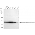 LifeSab™ ATF5 Rabbit mAb (20 μl)