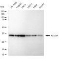 LifeSab™ ALDOA Rabbit mAb (20 μl)