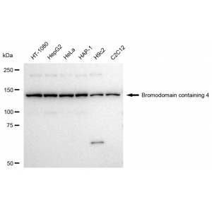 LifeSab™ BRD4 Rabbit mAb (20 μl)