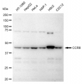 LifeSab™ CCR8 Rabbit mAb (20 μl)