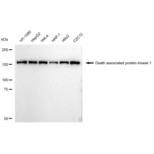 LifeSab™ DAPK1 Rabbit mAb (20 μl)