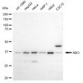 LifeSab™ ABO Rabbit mAb (20 μl)