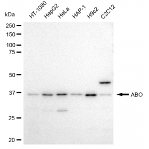 LifeSab™ ABO Rabbit mAb (20 μl)