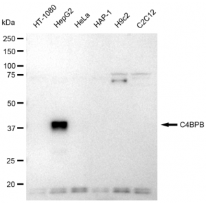 LifeSab™ C4BPB Rabbit mAb (20 μl)