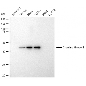 LifeSab™ CKB Rabbit mAb (20 μl)