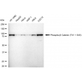 LifeSab™ Phospho-CTNNB1 (T41 + S45) Rabbit mAb (20 μl)