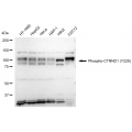 LifeSab™ Phospho-CTNND1 (Y228) Rabbit mAb (20 μl)