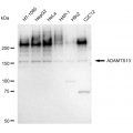 LifeSab™ ADAMTS13 Rabbit mAb (20 μl)