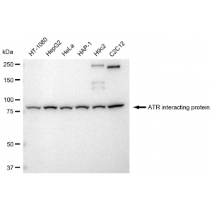 LifeSab™ ATRIP Rabbit mAb (20 μl)