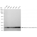 LifeSab™ Histone H3 (mono methyl K18) Rabbit mAb (20 μl)