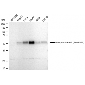 LifeSab™ Phospho-Smad5 (S463/465) Rabbit mAb (20 μl)