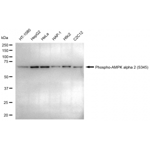 LifeSab™ Phospho-PRKAA2 (S345) Rabbit mAb (20 μl)