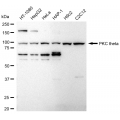 LifeSab™ PRKCT Rabbit mAb (20 μl)