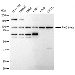 LifeSab™ PRKCT Rabbit mAb (20 μl)