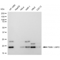 LifeSab™ PSMB9 Rabbit mAb (20 μl)