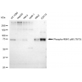 LifeSab™ Phospho-RSK1 p90 (T573) Rabbit mAb (20 μl)