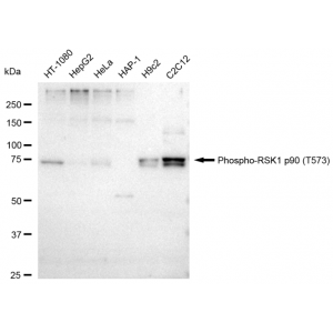 LifeSab™ Phospho-RSK1 p90 (T573) Rabbit mAb (20 μl)