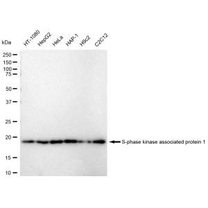 LifeSab™ SKP1 Rabbit mAb (20 μl)