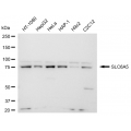 LifeSab™ SLC6A5 Rabbit mAb (20 μl)