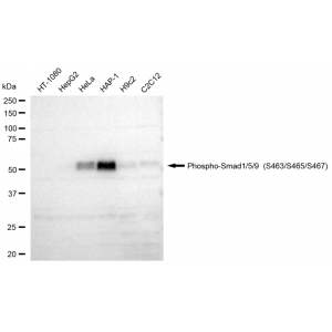 LifeSab™ Phospho-Smad1/5/9 (S463/S465/S467) Rabbit mAb (20 μl)