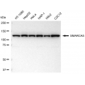 LifeSab™ SMARCA5 Rabbit mAb (20 μl)