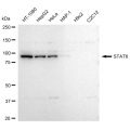 LifeSab™ STAT6 Rabbit mAb (20 μl)