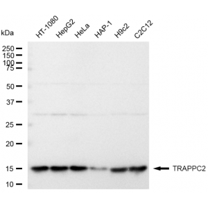 LifeSab™ TRAPPC2 Rabbit mAb (20 μl)