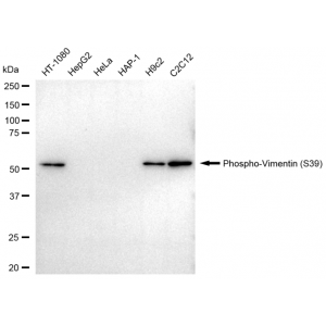 LifeSab™ Phospho-VIM (S39) Rabbit mAb (20 μl)