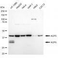 LifeSab™ ACP5 Rabbit mAb (20 μl)