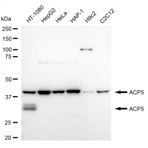 LifeSab™ ACP5 Rabbit mAb (20 μl)