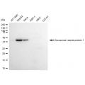 LifeSab™ ACRV1 Rabbit mAb (20 μl)