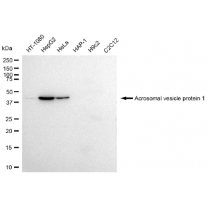 LifeSab™ ACRV1 Rabbit mAb (20 μl)