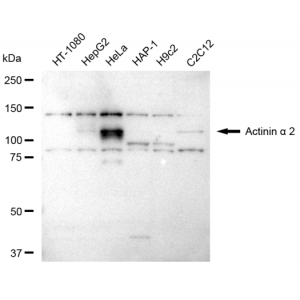 LifeSab™ ACTN2 Rabbit mAb (20 μl)