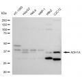 LifeSab™ ADH1A Rabbit mAb (20 μl)