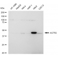 LifeSab™ AGTR2 Rabbit mAb (20 μl)