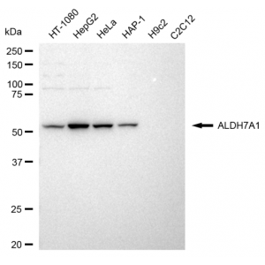 LifeSab™ ALDH7A1 Rabbit mAb (20 μl)