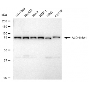 LifeSab™ ALDH16A1 Rabbit mAb (20 μl)