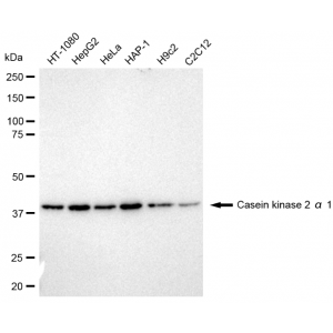 LifeSab™ CK2A1 Rabbit mAb (20 μl)