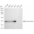 LifeSab™ AURKB Rabbit mAb (20 μl)