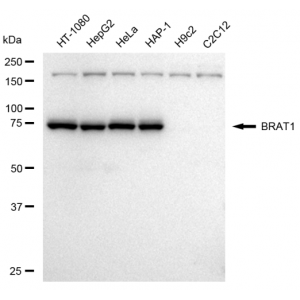 LifeSab™ BRAT1 Rabbit mAb (20 μl)